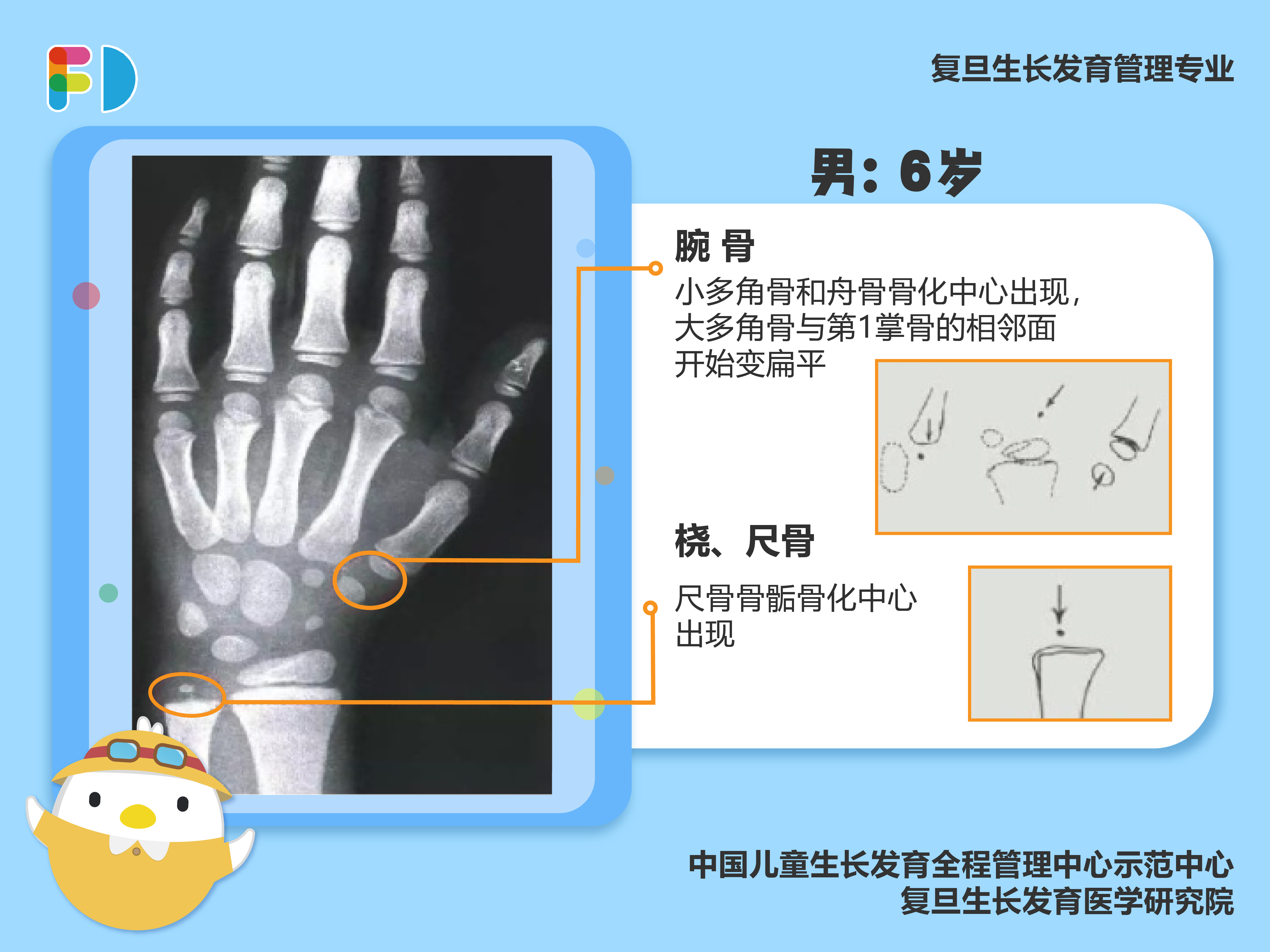 骨骺是什么图片看看图片