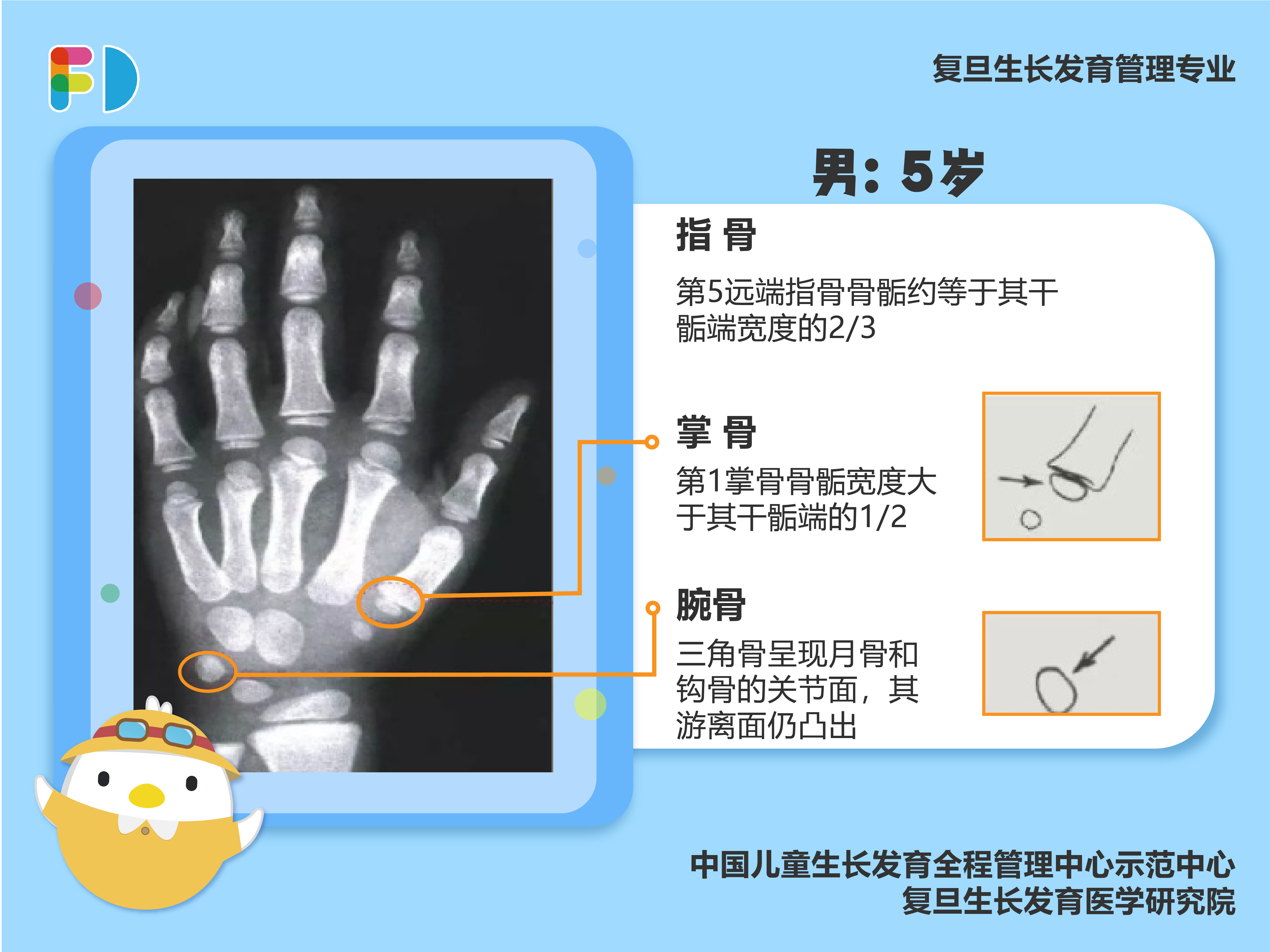 94孩子骨龄偏大的孩子如何增高 94骨骺线闭合与身高增长 很多家长