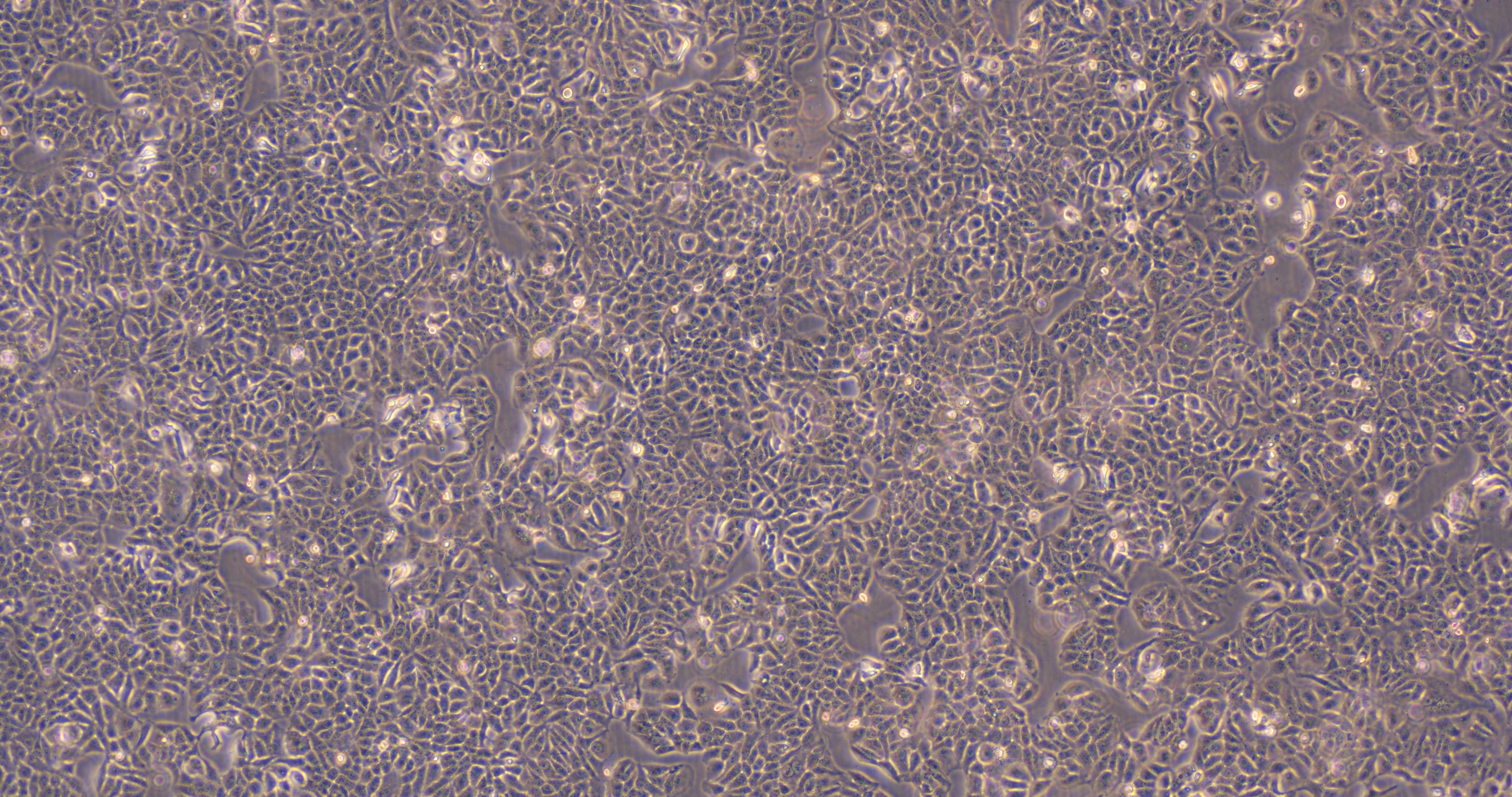 海拉细胞实物图图片